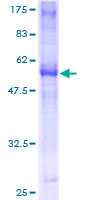 TNFRSF14 / CD270 / HVEM Protein - 12.5% SDS-PAGE of human TNFRSF14 stained with Coomassie Blue