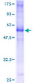 TNFRSF14 / CD270 / HVEM Protein - 12.5% SDS-PAGE of human TNFRSF14 stained with Coomassie Blue