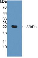 TNFRSF14 / CD270 / HVEM Protein - Active Tumor Necrosis Factor Receptor Superfamily, Member 14 (TNFRSF14) by WB