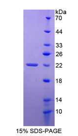 TNFRSF14 / CD270 / HVEM Protein - Recombinant  Tumor Necrosis Factor Receptor Superfamily, Member 14 By SDS-PAGE