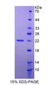 TNFRSF14 / CD270 / HVEM Protein - Recombinant  Tumor Necrosis Factor Receptor Superfamily, Member 14 By SDS-PAGE