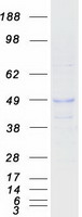 TNFRSF14 / CD270 / HVEM Protein - Purified recombinant protein TNFRSF14 was analyzed by SDS-PAGE gel and Coomassie Blue Staining