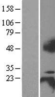 TNFRSF17 / BCMA Protein - Western validation with an anti-DDK antibody * L: Control HEK293 lysate R: Over-expression lysate