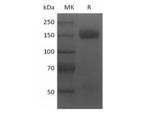 TNFRSF17 / BCMA Protein - Recombinant Human BCMA/TNFRSF17 (N-6His-Flag)