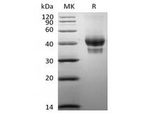 TNFRSF17 / BCMA Protein - Recombinant Human BCMA/TNFRSF17 (C-Fc-Avi) Biotinylated