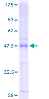 TNFRSF17 / BCMA Protein - 12.5% SDS-PAGE of human TNFRSF17 stained with Coomassie Blue