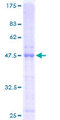 TNFRSF17 / BCMA Protein - 12.5% SDS-PAGE of human TNFRSF17 stained with Coomassie Blue