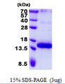 TNFRSF17 / BCMA Protein
