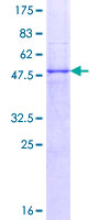 TNFRSF18 / GITR Protein - 12.5% SDS-PAGE of human TNFRSF18 stained with Coomassie Blue