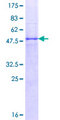 TNFRSF18 / GITR Protein - 12.5% SDS-PAGE of human TNFRSF18 stained with Coomassie Blue