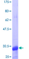 TNFRSF18 / GITR Protein - 12.5% SDS-PAGE Stained with Coomassie Blue.
