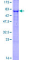 TNFRSF19 / TROY Protein - 12.5% SDS-PAGE of human TNFRSF19 stained with Coomassie Blue