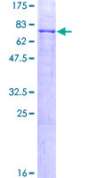 TNFRSF19L / RELT Protein - 12.5% SDS-PAGE of human TNFRSF19L stained with Coomassie Blue
