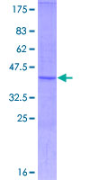 TNFRSF19L / RELT Protein - 12.5% SDS-PAGE Stained with Coomassie Blue.