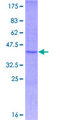 TNFRSF19L / RELT Protein - 12.5% SDS-PAGE Stained with Coomassie Blue.