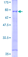 TNFRSF1A / TNFR1 Protein - 12.5% SDS-PAGE of human TNFRSF1A stained with Coomassie Blue
