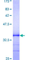 TNFRSF1A / TNFR1 Protein - 12.5% SDS-PAGE Stained with Coomassie Blue.