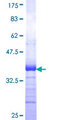 TNFRSF1A / TNFR1 Protein - 12.5% SDS-PAGE Stained with Coomassie Blue.