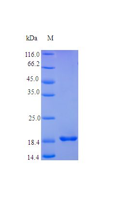 TNFRSF1B / TNFR2 Protein