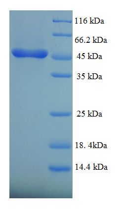 TNFRSF1B / TNFR2 Protein