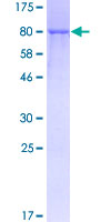 TNFRSF1B / TNFR2 Protein - 12.5% SDS-PAGE of human TNFRSF1B stained with Coomassie Blue
