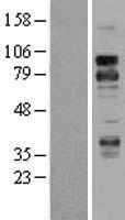 TNFRSF21 / DR6 Protein - Western validation with an anti-DDK antibody * L: Control HEK293 lysate R: Over-expression lysate