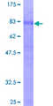 TNFRSF21 / DR6 Protein - 12.5% SDS-PAGE of human TNFRSF21 stained with Coomassie Blue