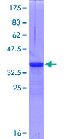 TNFRSF25 / DR3 Protein - 12.5% SDS-PAGE Stained with Coomassie Blue.