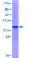 TNFRSF25 / DR3 Protein - 12.5% SDS-PAGE Stained with Coomassie Blue.