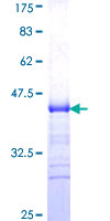 TNFRSF4 / CD134 / OX40 Protein - 12.5% SDS-PAGE Stained with Coomassie Blue.