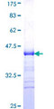 TNFRSF4 / CD134 / OX40 Protein - 12.5% SDS-PAGE Stained with Coomassie Blue.