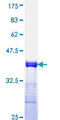 TNFRSF6B / DCR3 Protein - 12.5% SDS-PAGE Stained with Coomassie Blue.