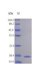 TNFRSF9 / 4-1BB / CD137 Protein