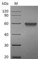 TNFRSF9 / 4-1BB / CD137 Protein - (Tris-Glycine gel) Discontinuous SDS-PAGE (reduced) with 5% enrichment gel and 15% separation gel.