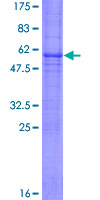 TNFRSF9 / 4-1BB / CD137 Protein - 12.5% SDS-PAGE of human TNFRSF9 stained with Coomassie Blue