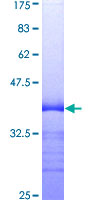TNFRSF9 / 4-1BB / CD137 Protein - 12.5% SDS-PAGE Stained with Coomassie Blue.