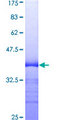 TNFRSF9 / 4-1BB / CD137 Protein - 12.5% SDS-PAGE Stained with Coomassie Blue.