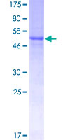 TNFSF10 / TRAIL Protein - 12.5% SDS-PAGE of human TNFSF10 stained with Coomassie Blue