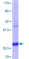 TNFSF11 / RANKL / TRANCE Protein - 12.5% SDS-PAGE Stained with Coomassie Blue.