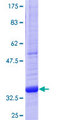 TNFSF11 / RANKL / TRANCE Protein - 12.5% SDS-PAGE Stained with Coomassie Blue.