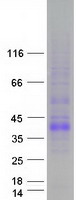 TNFSF11 / RANKL / TRANCE Protein - Purified recombinant protein TNFSF11 was analyzed by SDS-PAGE gel and Coomassie Blue Staining