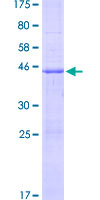 TNFSF12 / TWEAK Protein - 12.5% SDS-PAGE of human TNFSF12 stained with Coomassie Blue