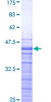 TNFSF12 / TWEAK Protein - 12.5% SDS-PAGE Stained with Coomassie Blue.
