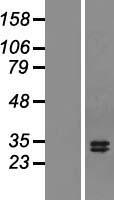 TNFSF13 / APRIL Protein - Western validation with an anti-DDK antibody * L: Control HEK293 lysate R: Over-expression lysate