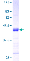 TNFSF13 / APRIL Protein - 12.5% SDS-PAGE of human TNFSF13 stained with Coomassie Blue