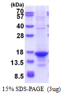 TNFSF13 / APRIL Protein
