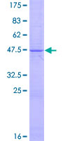 TNFSF14 / LIGHT Protein - 12.5% SDS-PAGE of human TNFSF14 stained with Coomassie Blue