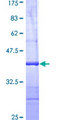 TNFSF14 / LIGHT Protein - 12.5% SDS-PAGE Stained with Coomassie Blue.