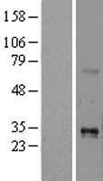 TNFSF15 / TL1A / VEGI Protein - Western validation with an anti-DDK antibody * L: Control HEK293 lysate R: Over-expression lysate