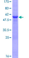 TNFSF15 / TL1A / VEGI Protein - 12.5% SDS-PAGE of human TNFSF15 stained with Coomassie Blue